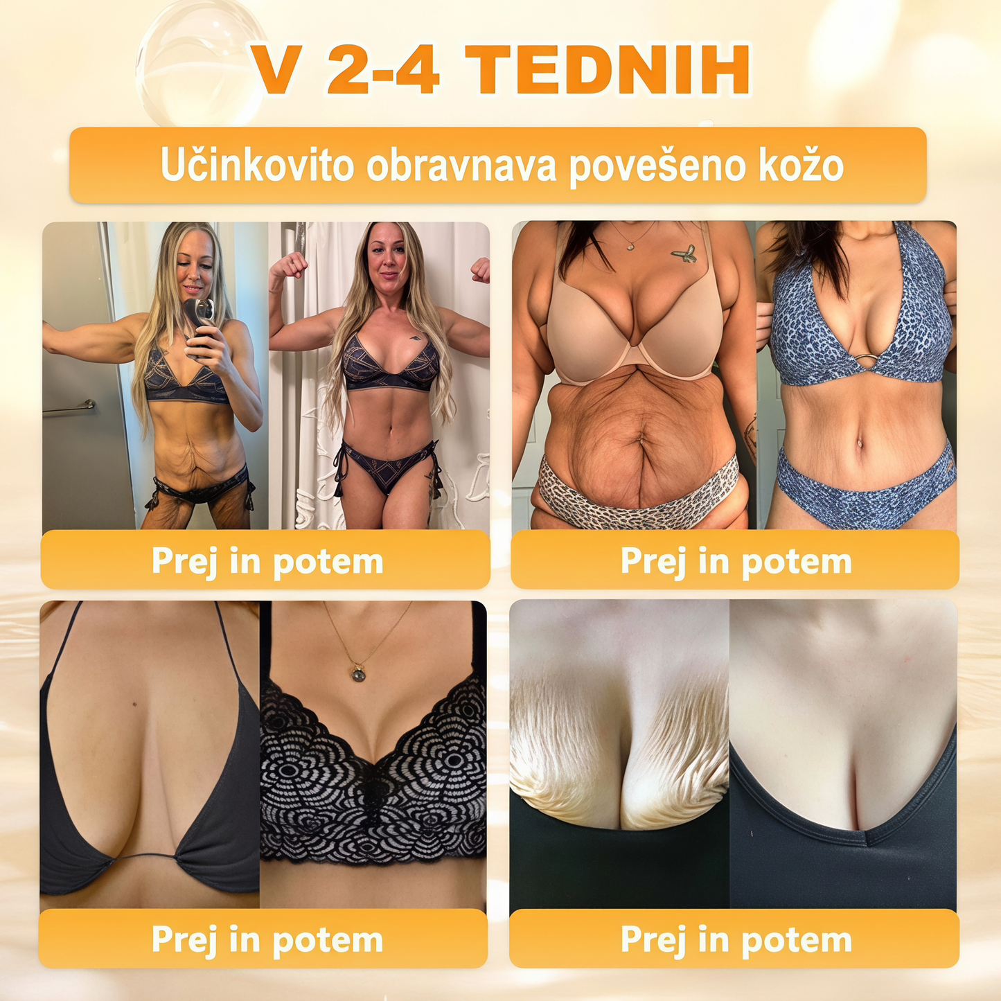🔥🔥 Priporočilo bolnišnice   • Uradna trgovina ✨𝗗𝗼𝗿𝗺𝗼𝐫𝐧𝐚®  Krema za obnovo kože s čebeljim strupom (Copy)