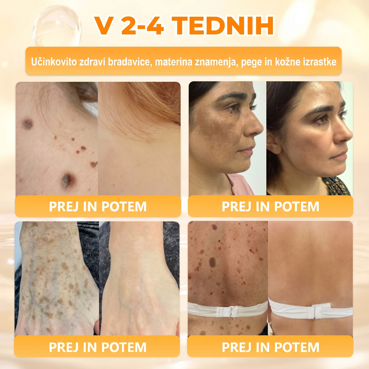 🔥🔥 Priporočilo bolnišnice   • Uradna trgovina ✨𝗗𝗼𝗿𝗺𝗼𝐫𝐧𝐚®  Krema za obnovo kože s čebeljim strupom (Copy)