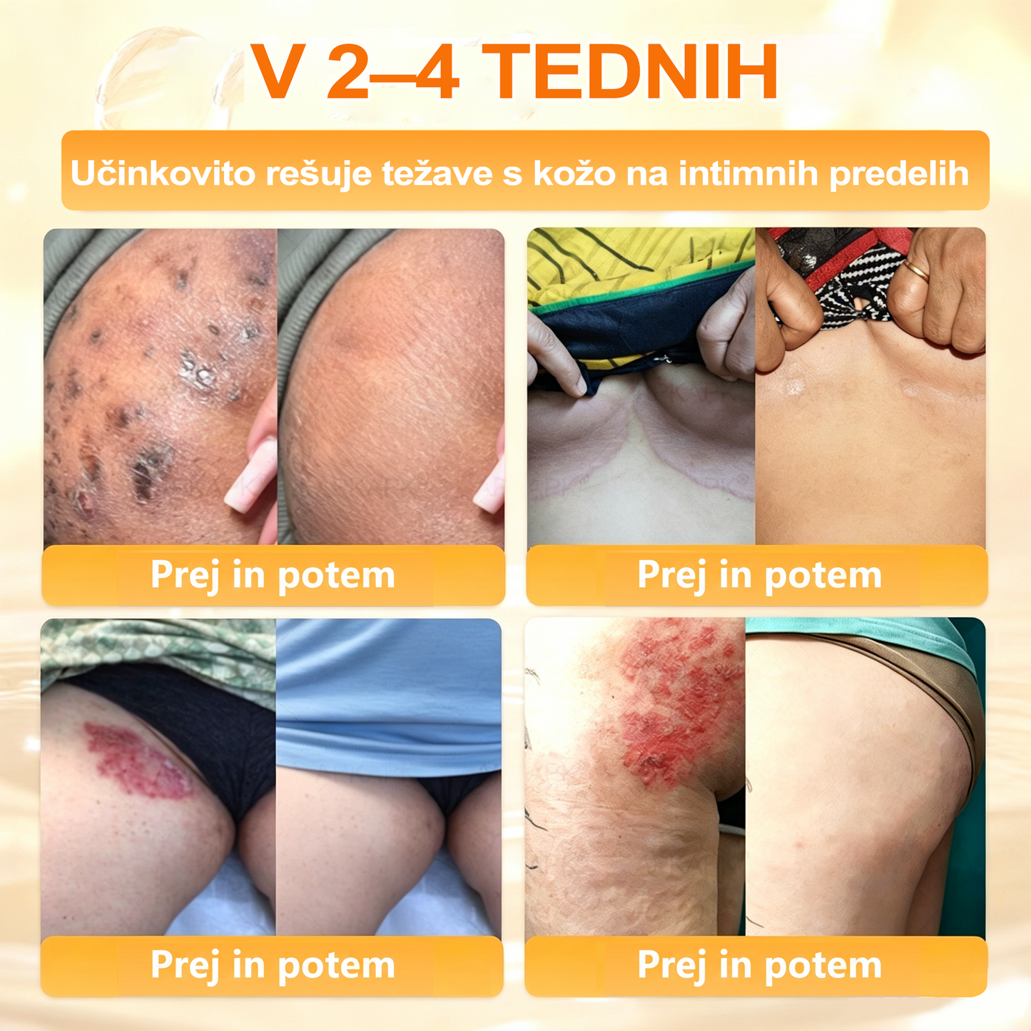 🔥🔥 Priporočilo bolnišnice   • Uradna trgovina ✨𝗗𝗼𝗿𝗺𝗼𝐫𝐧𝐚®  Krema za obnovo kože s čebeljim strupom (Copy)