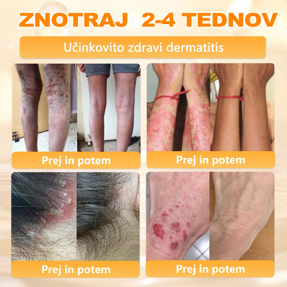 🔥🔥 Priporočilo bolnišnice   • Uradna trgovina ✨𝗗𝗼𝗿𝗺𝗼𝐫𝐧𝐚®  Krema za obnovo kože s čebeljim strupom (Copy)