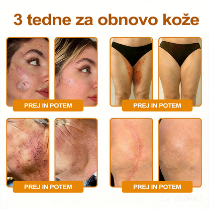 🔥🔥 Priporočilo bolnišnice   • Uradna trgovina ✨𝗗𝗼𝗿𝗺𝗼𝐫𝐧𝐚®  Krema za obnovo kože s čebeljim strupom (Copy)