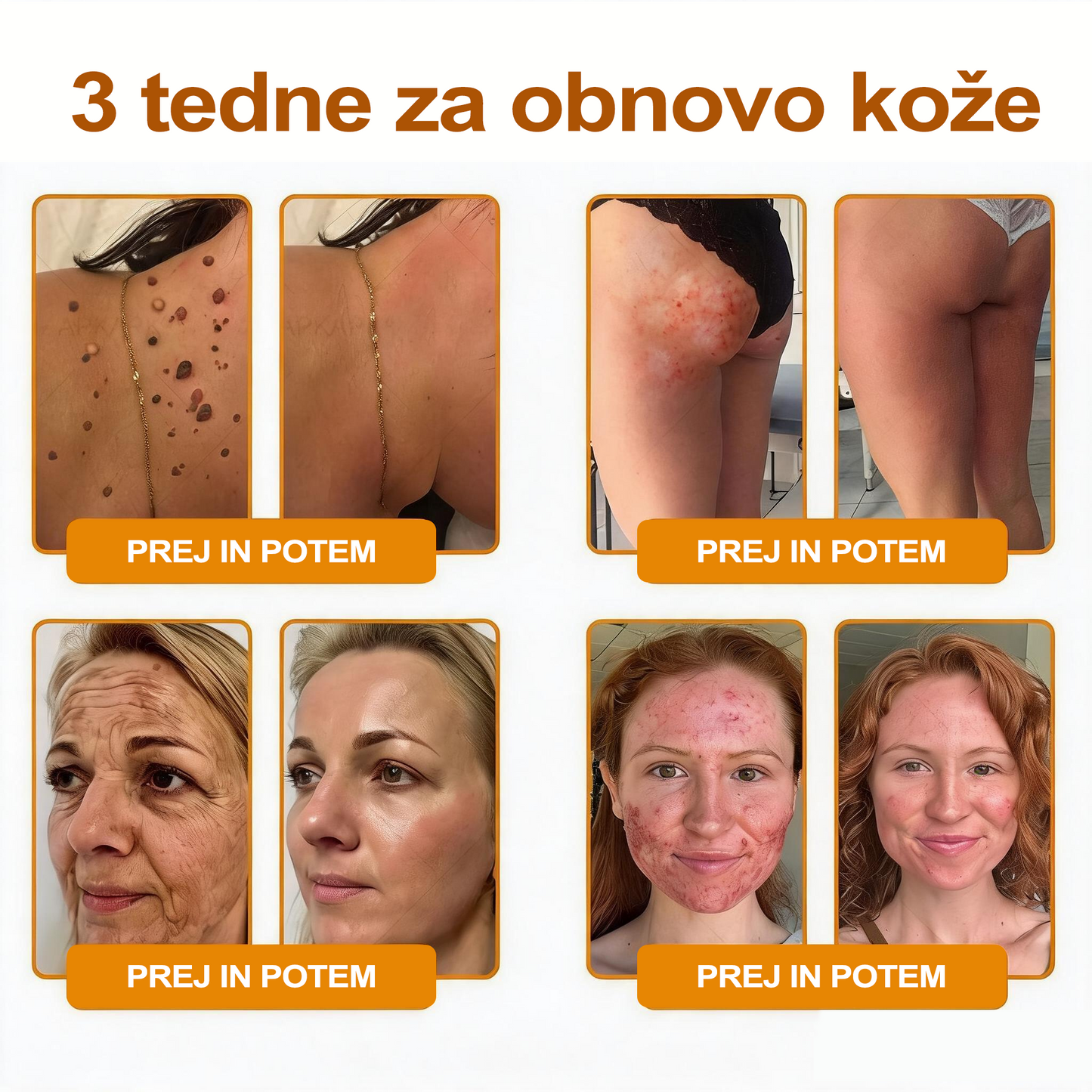 🔥🔥 Priporočilo bolnišnice   • Uradna trgovina ✨𝗗𝗼𝗿𝗺𝗼𝐫𝐧𝐚®  Krema za obnovo kože s čebeljim strupom (Copy)