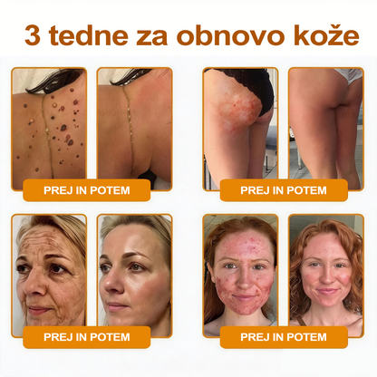 🔥🔥 Priporočilo bolnišnice   • Uradna trgovina ✨𝗗𝗼𝗿𝗺𝗼𝐫𝐧𝐚®  Krema za obnovo kože s čebeljim strupom (Copy)