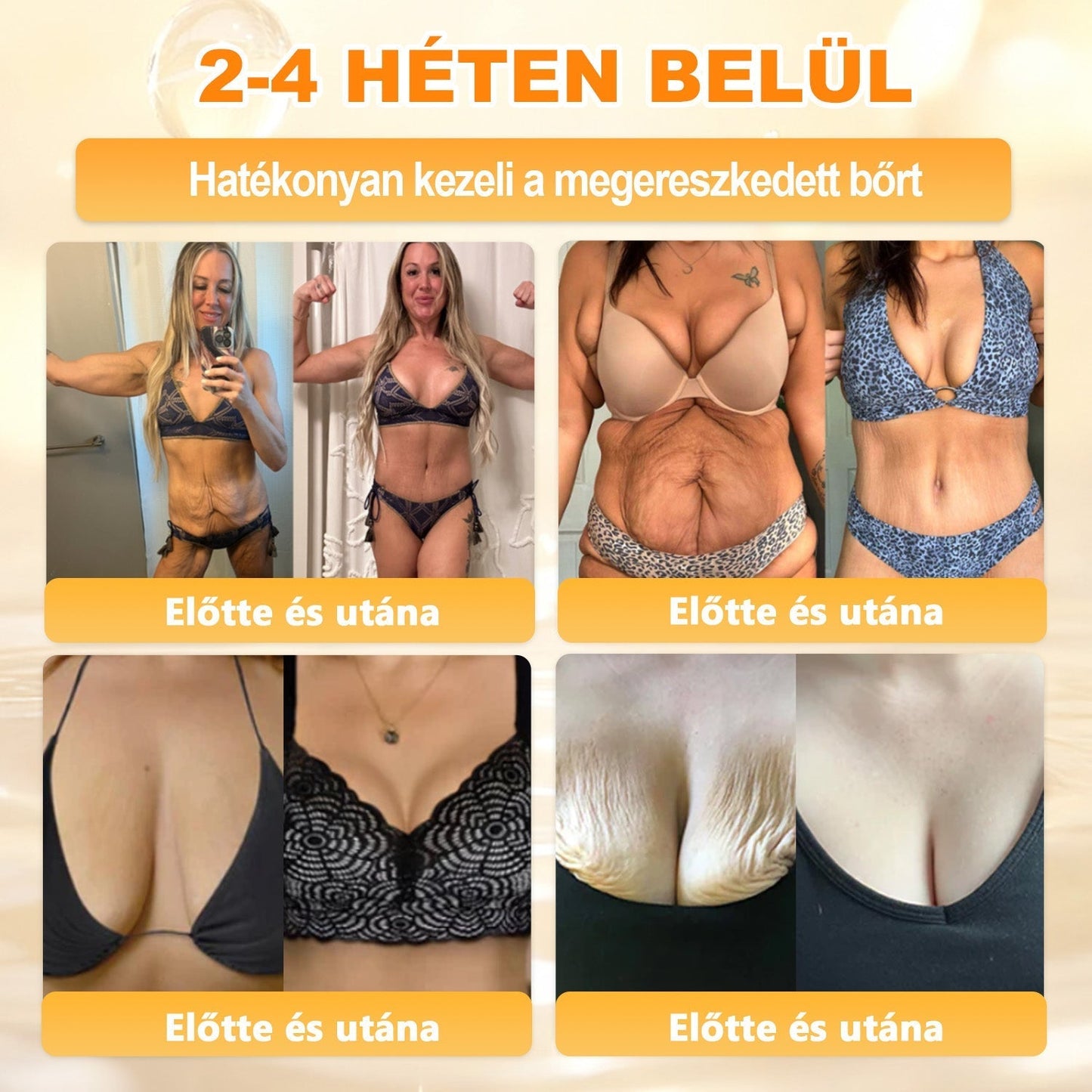 🔥🔥Ajánlott a Semmelweis Kórház által · BENU hivatalos üzlet✨𝖠𝖯𝖪𝖠𝖯𝖪® méhméreges bőrmegújító krém