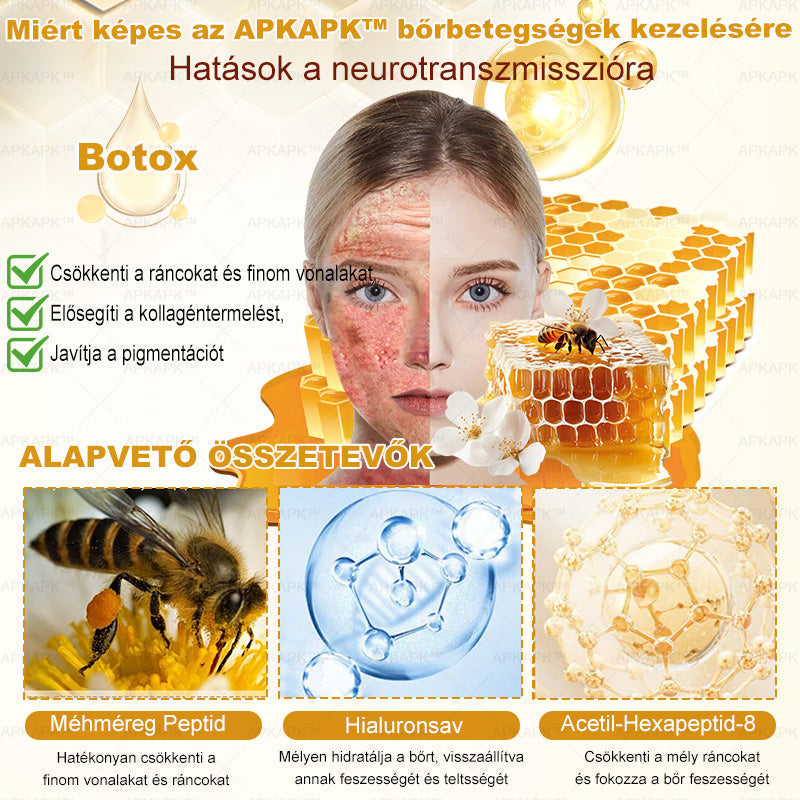 🔥🔥Ajánlott a Semmelweis Kórház által · BENU hivatalos üzlet✨𝖠𝖯𝖪𝖠𝖯𝖪® méhméreges bőrmegújító krém