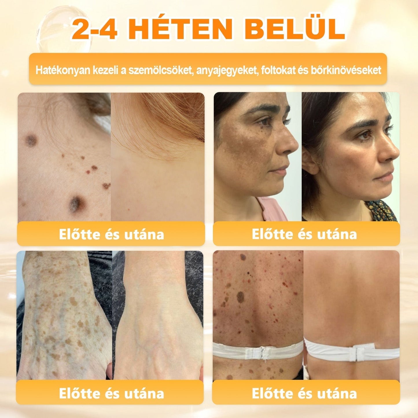 🔥🔥Ajánlott a Semmelweis Kórház által · BENU hivatalos üzlet✨𝖠𝖯𝖪𝖠𝖯𝖪® méhméreges bőrmegújító krém