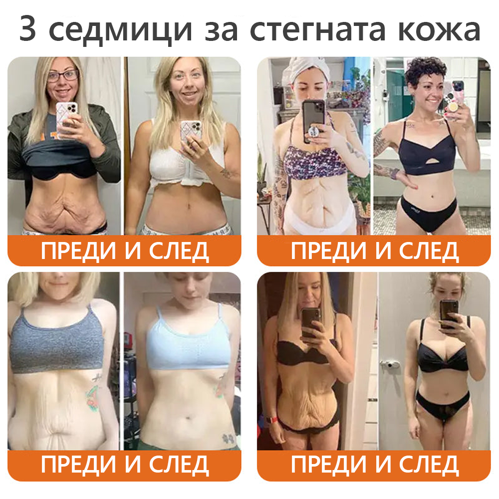 Произведено и доставено от България 🌵𝐃𝐨𝐫𝐦𝐨𝗿𝗻𝗮® пчелна отрова комплексен крем🌟ПОСЛЕДЕН ДЕН 80% ОТСТЪПКА 🔥🔥