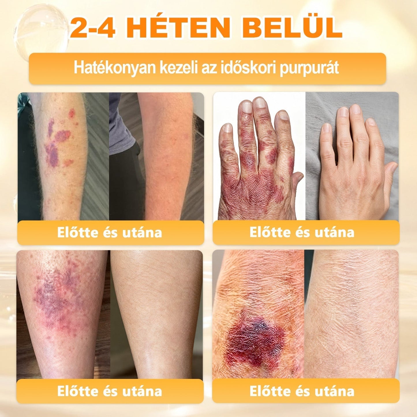 🔥🔥Ajánlott a Semmelweis Kórház által · BENU hivatalos üzlet✨𝖠𝖯𝖪𝖠𝖯𝖪® méhméreges bőrmegújító krém