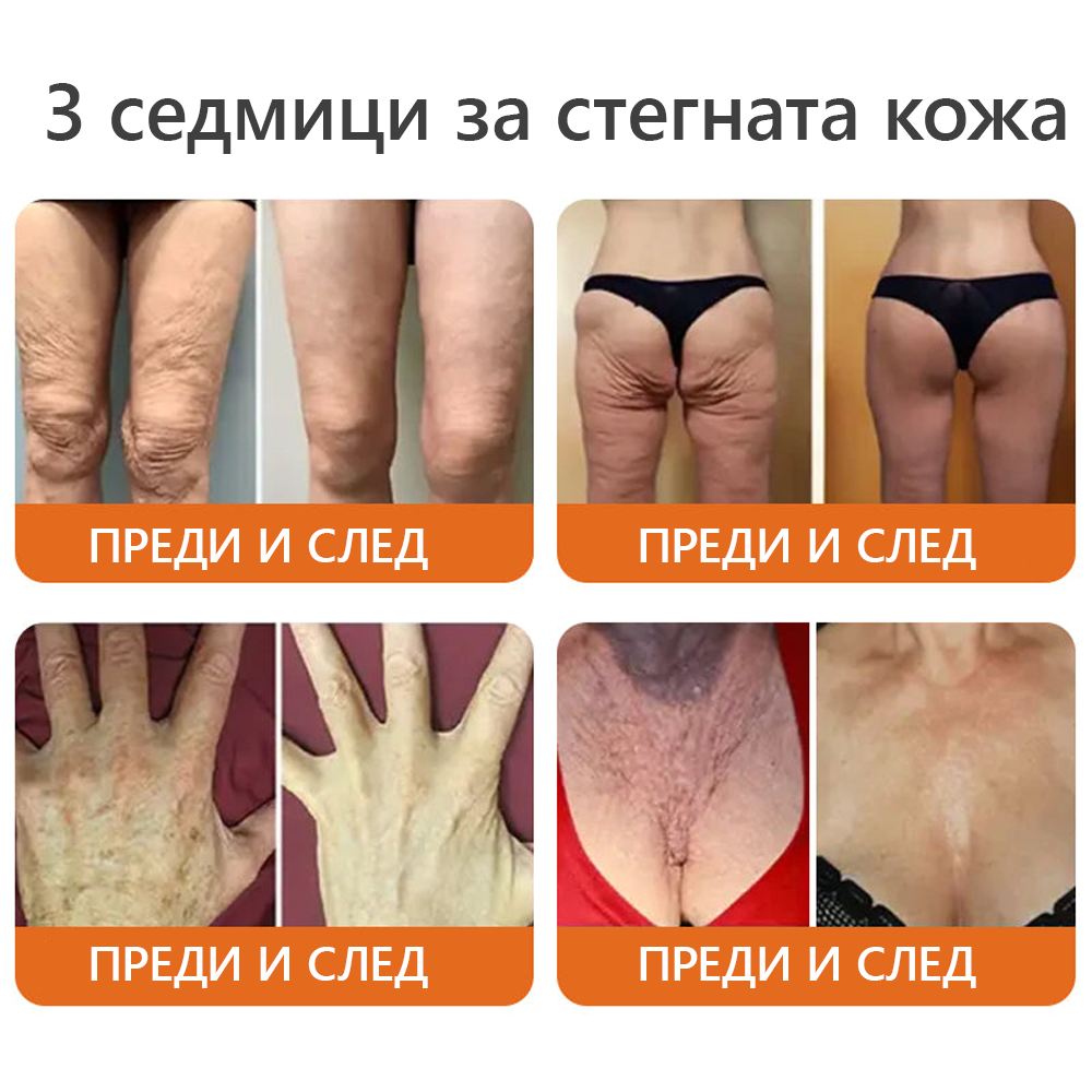 Произведено и доставено от България 🌵𝐃𝐨𝐫𝐦𝐨𝗿𝗻𝗮® пчелна отрова комплексен крем🌟ПОСЛЕДЕН ДЕН 80% ОТСТЪПКА 🔥🔥