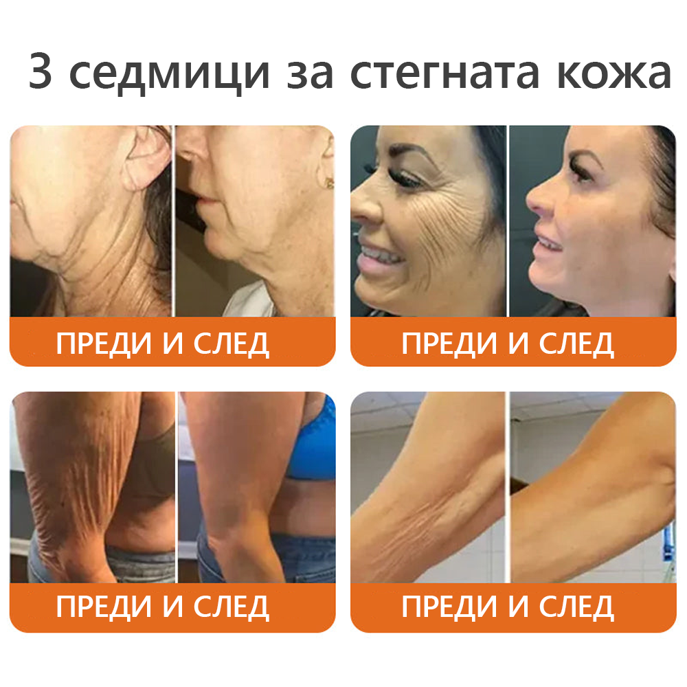 Произведено и доставено от България 🌵𝐃𝐨𝐫𝐦𝐨𝗿𝗻𝗮® пчелна отрова комплексен крем🌟ПОСЛЕДЕН ДЕН 80% ОТСТЪПКА 🔥🔥