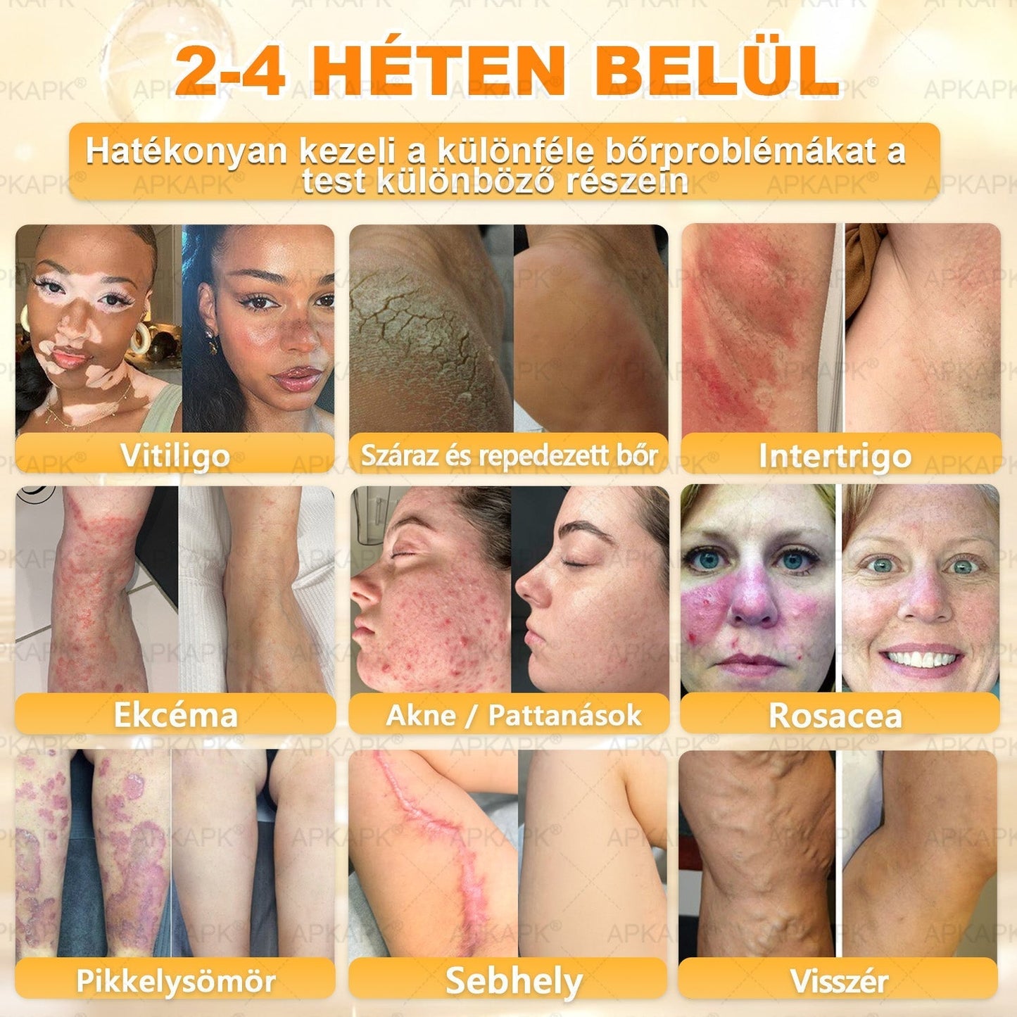 🔥🔥Ajánlott a Semmelweis Kórház által · BENU hivatalos üzlet✨𝖠𝖯𝖪𝖠𝖯𝖪® méhméreges bőrmegújító krém
