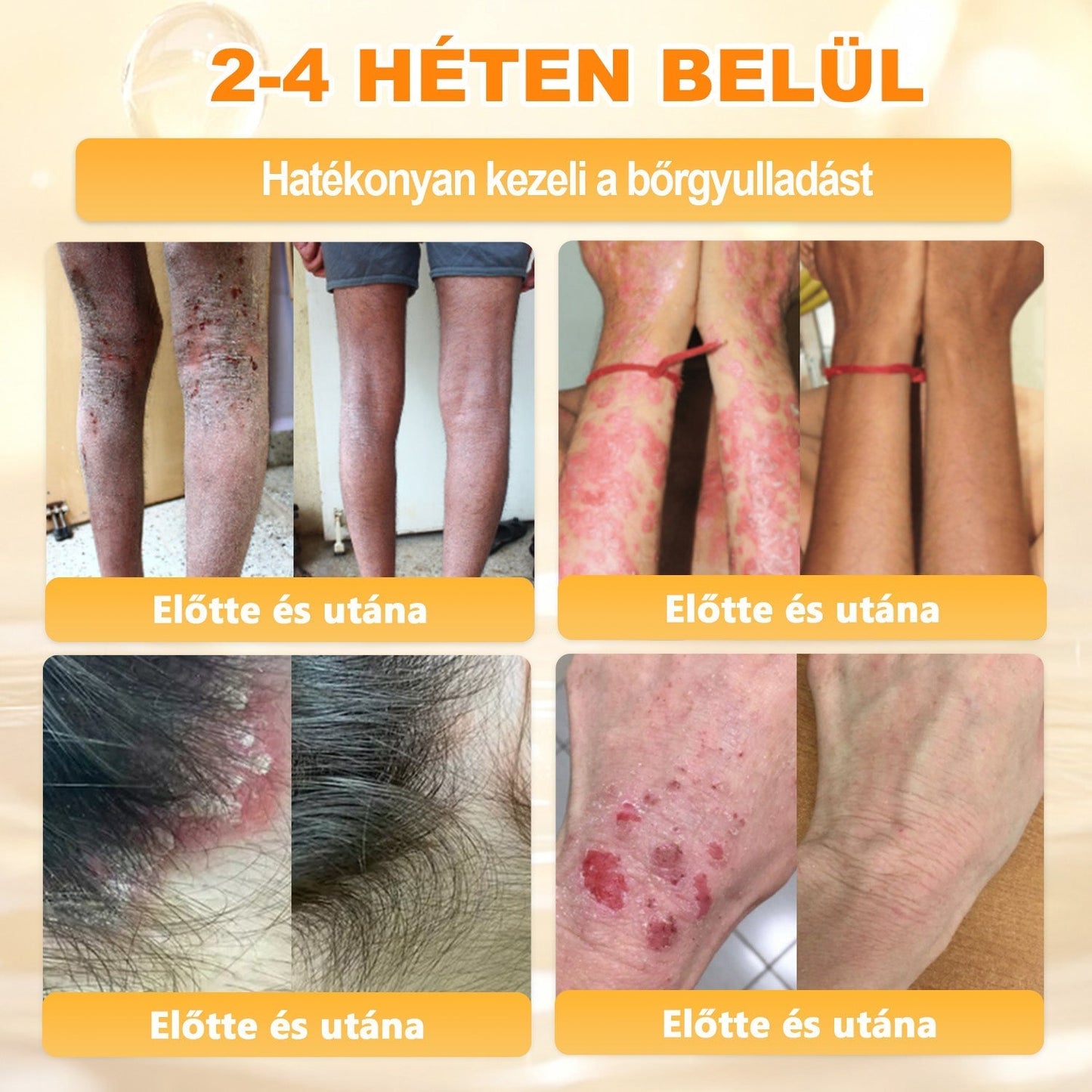 🔥🔥Ajánlott a Semmelweis Kórház által · BENU hivatalos üzlet✨𝖠𝖯𝖪𝖠𝖯𝖪® méhméreges bőrmegújító krém
