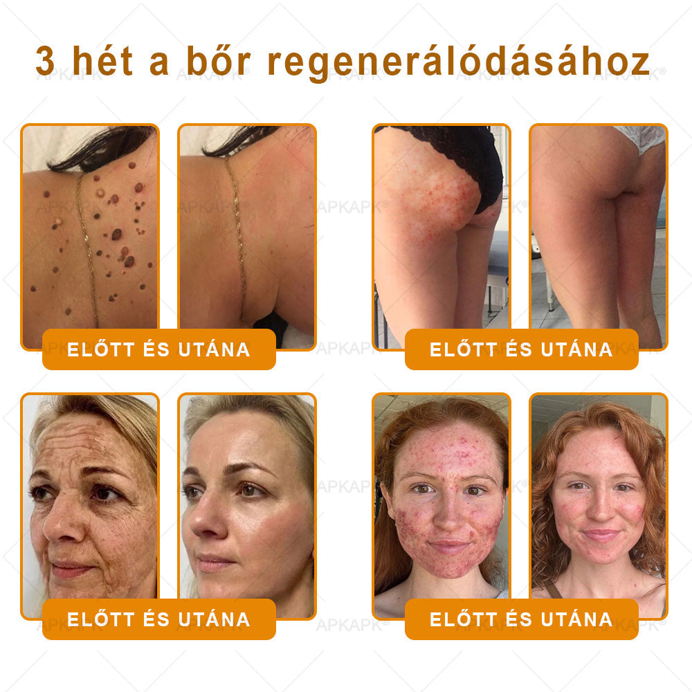 🔥🔥Ajánlott a Semmelweis Kórház által · BENU hivatalos üzlet✨𝖠𝖯𝖪𝖠𝖯𝖪® méhméreges bőrmegújító krém