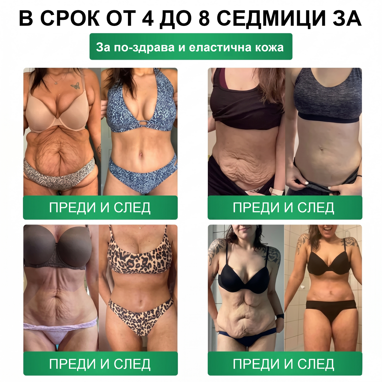 【Последен ден на промоция – 90% ОТСТЪПКА】🍈𝐅𝐥𝐨𝐫𝐢𝐬𝐦𝐚® Моринга 𝐗 Берберин 𝟏𝟎-𝐈𝐧-𝟏 Напреднал Нано Микроигли Пластир