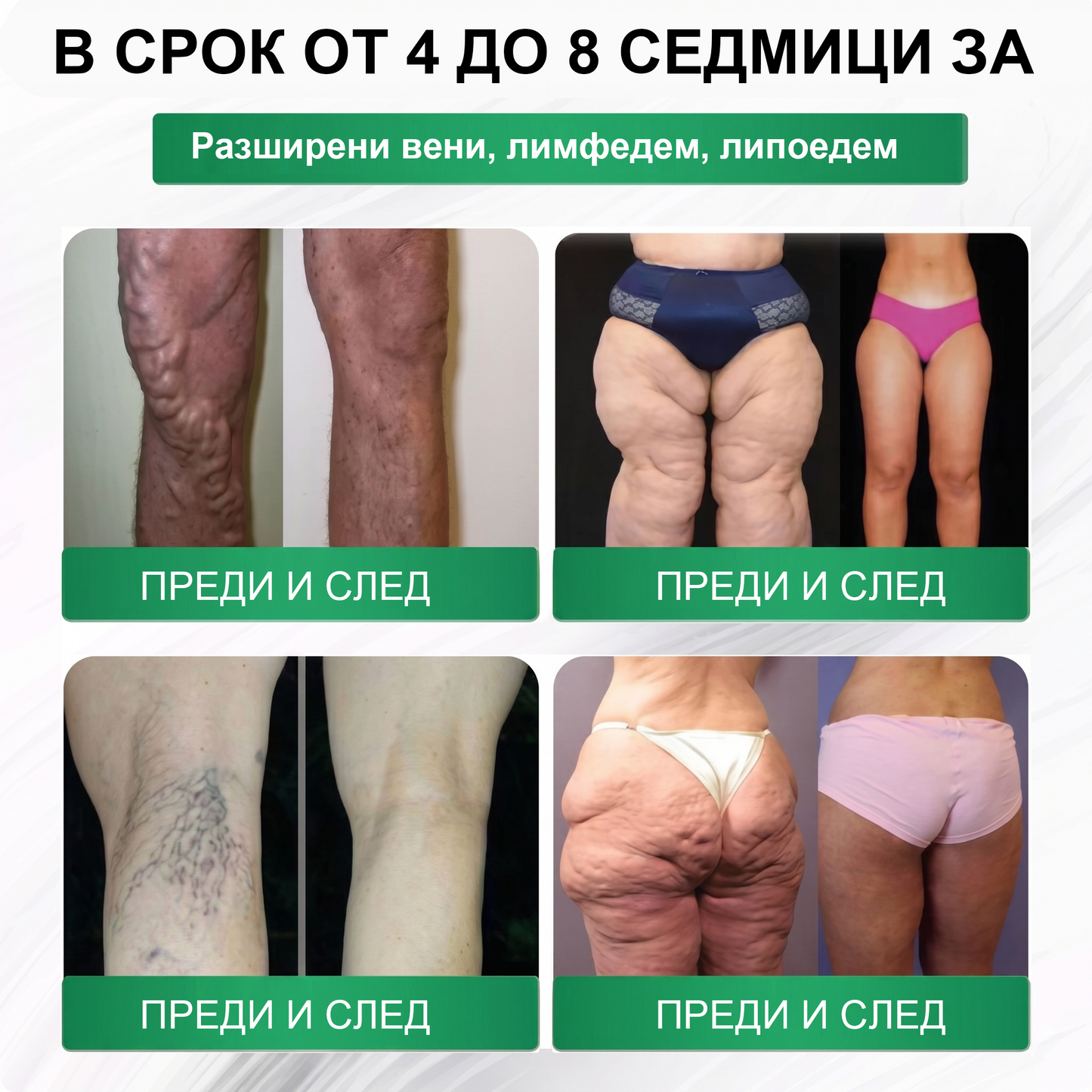 【Последен ден на промоция – 90% ОТСТЪПКА】🍈𝐅𝐥𝐨𝐫𝐢𝐬𝐦𝐚® Моринга 𝐗 Берберин 𝟏𝟎-𝐈𝐧-𝟏 Напреднал Нано Микроигли Пластир